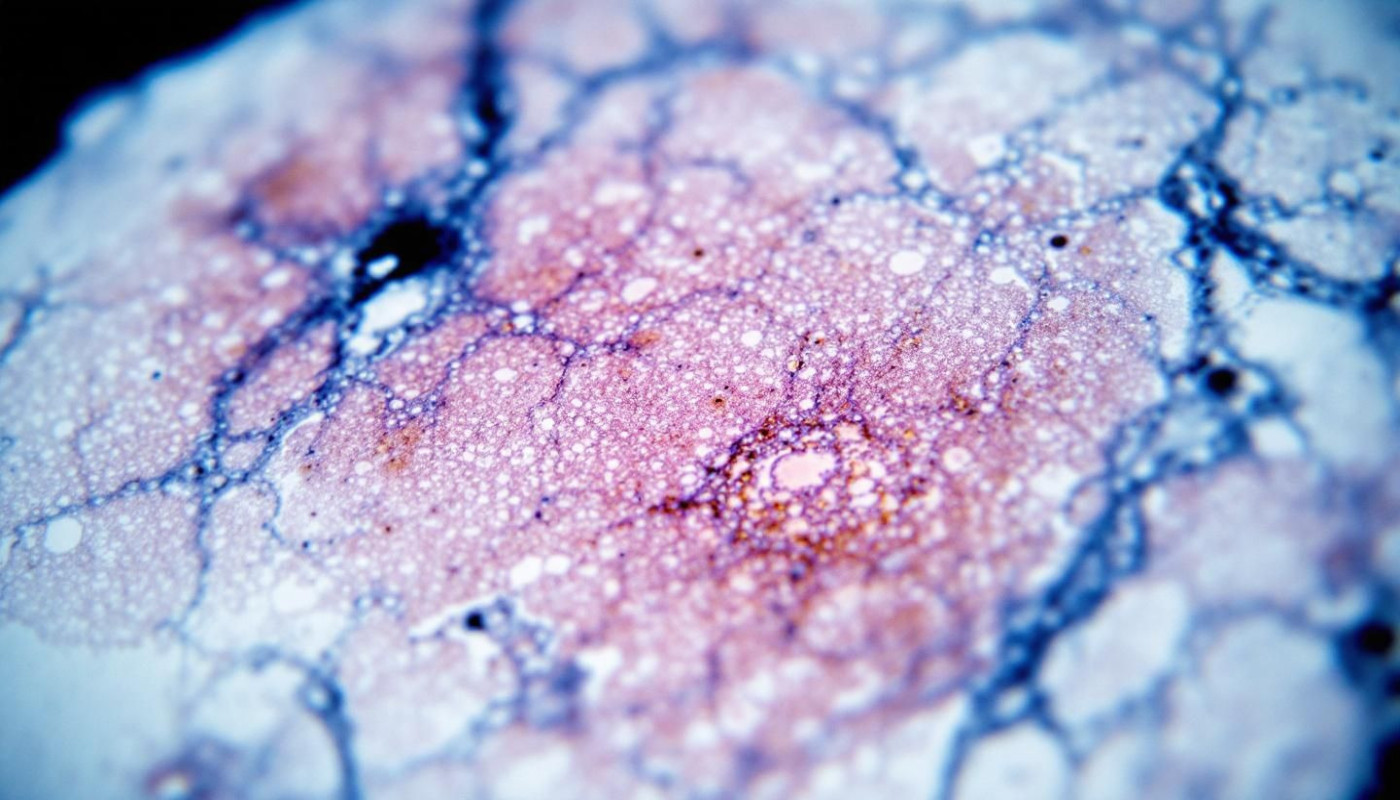 Décryptage : Comment l'inflammation accélère-t-elle le vieillissement de la peau ?